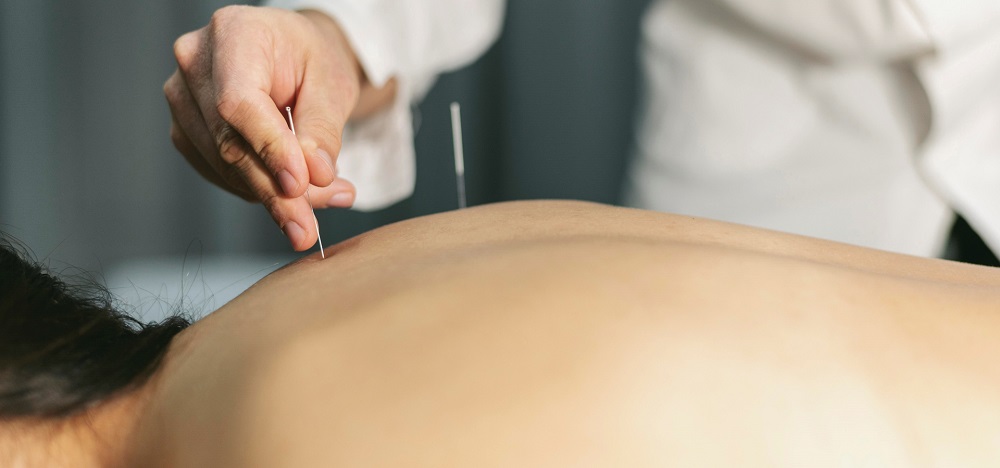 Acupuncturist