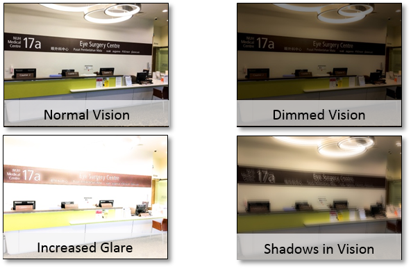 vision