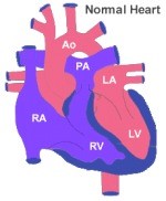 Normal Heart
