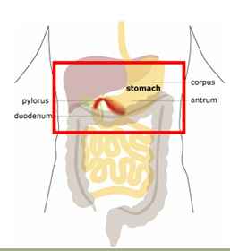 Functional Dyspepsia