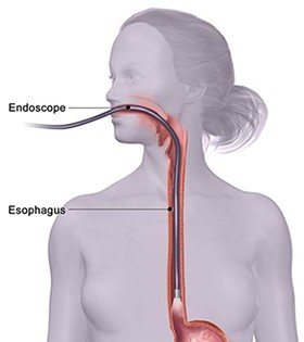 Endoscopy