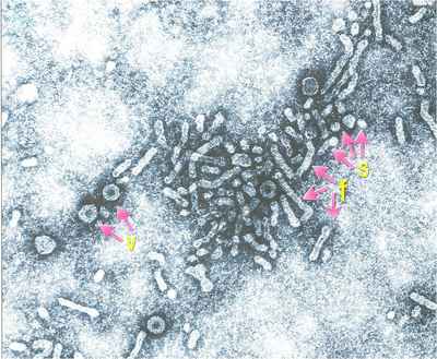 Hepatitis B virus