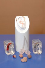 Cochlear implants
