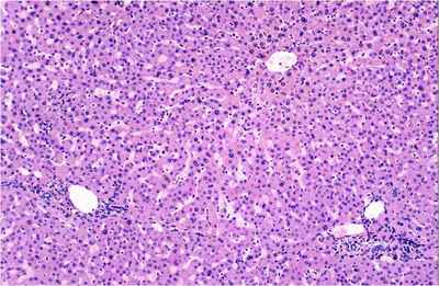 normal liver biopsy