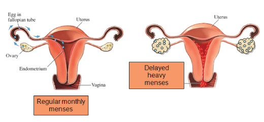Menses