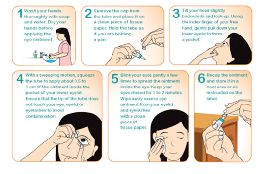 How to apply Chlortetracycline eye ointment
