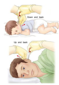 Instructions on eardrops administered into the ear