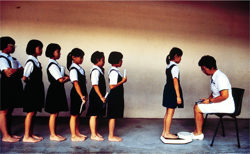 Scoliosis Screening Programme