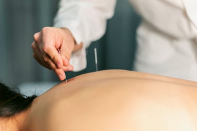 Acupuncturist